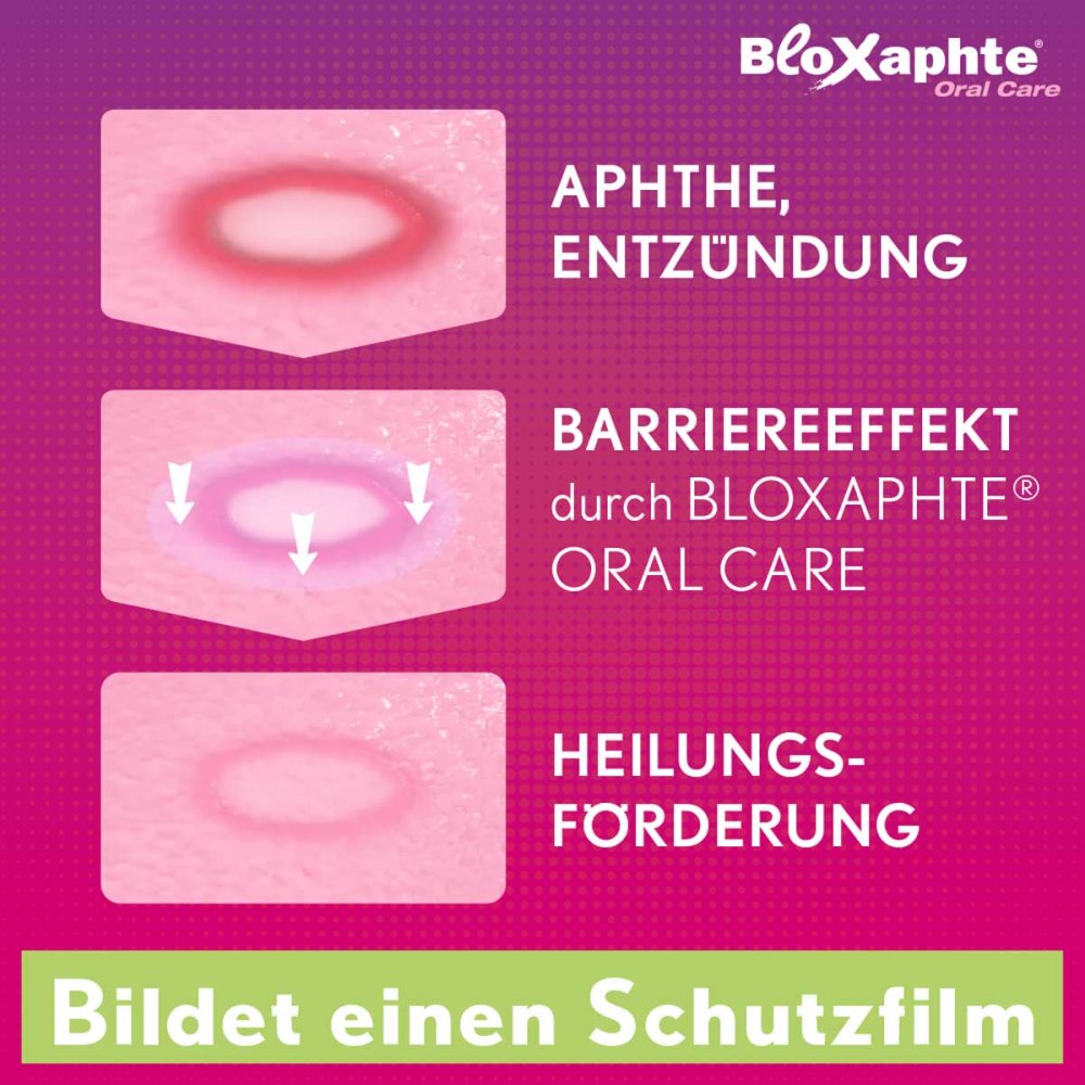 Bloxaphte Oral Care bei Aphthen für Kinder 15 ml