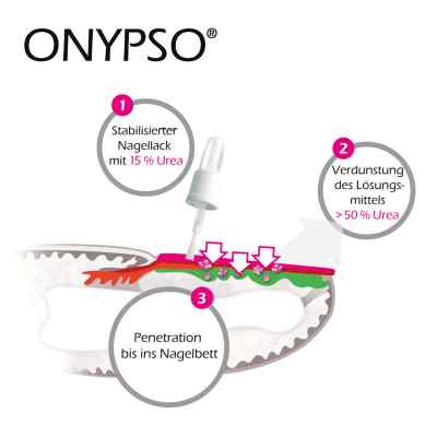 Onypso Nagellack bei apo-discounter.de bestellen