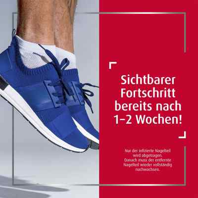 Canesten Extra-Nagelset gegen Nagelpilz (+15 Pflaster+Schaber) bei apo-discounter.de bestellen