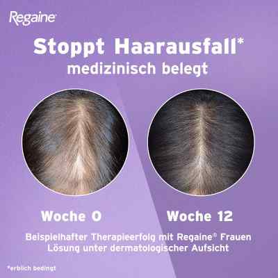 REGAINE Frauen Lösung bei erblich bedingtem Haarausfall bei apo-discounter.de bestellen