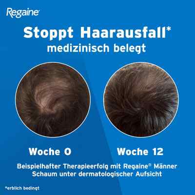 REGAINE Männer Lösung bei erblich bedingtem Haarausfall bei apo-discounter.de bestellen