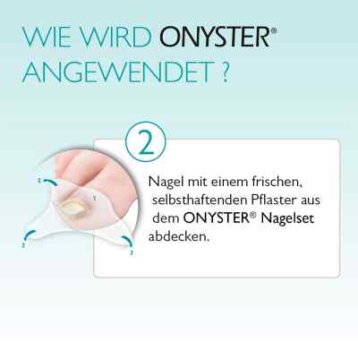 Onyster Nagelset bei apo-discounter.de bestellen