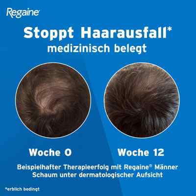 REGAINE Männer Schaum bei erblich bedingtem Haarausfall bei apo-discounter.de bestellen