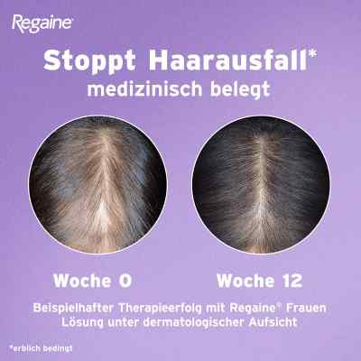 REGAINE Frauen Schaum bei erblich bedingtem Haarausfall bei apo-discounter.de bestellen