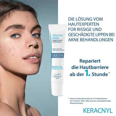 Ducray keracnyl Repair Lippenbalsam bei apo-discounter.de bestellen