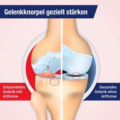 Gelencium Arthro Mischung bei apo-discounter.de bestellen