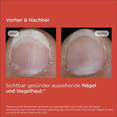 Isdin Si-nails Nagelhärter Stift bei apo-discounter.de bestellen