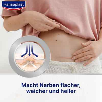 Hansaplast Pflaster zur Behandlung von Narben bei apo-discounter.de bestellen