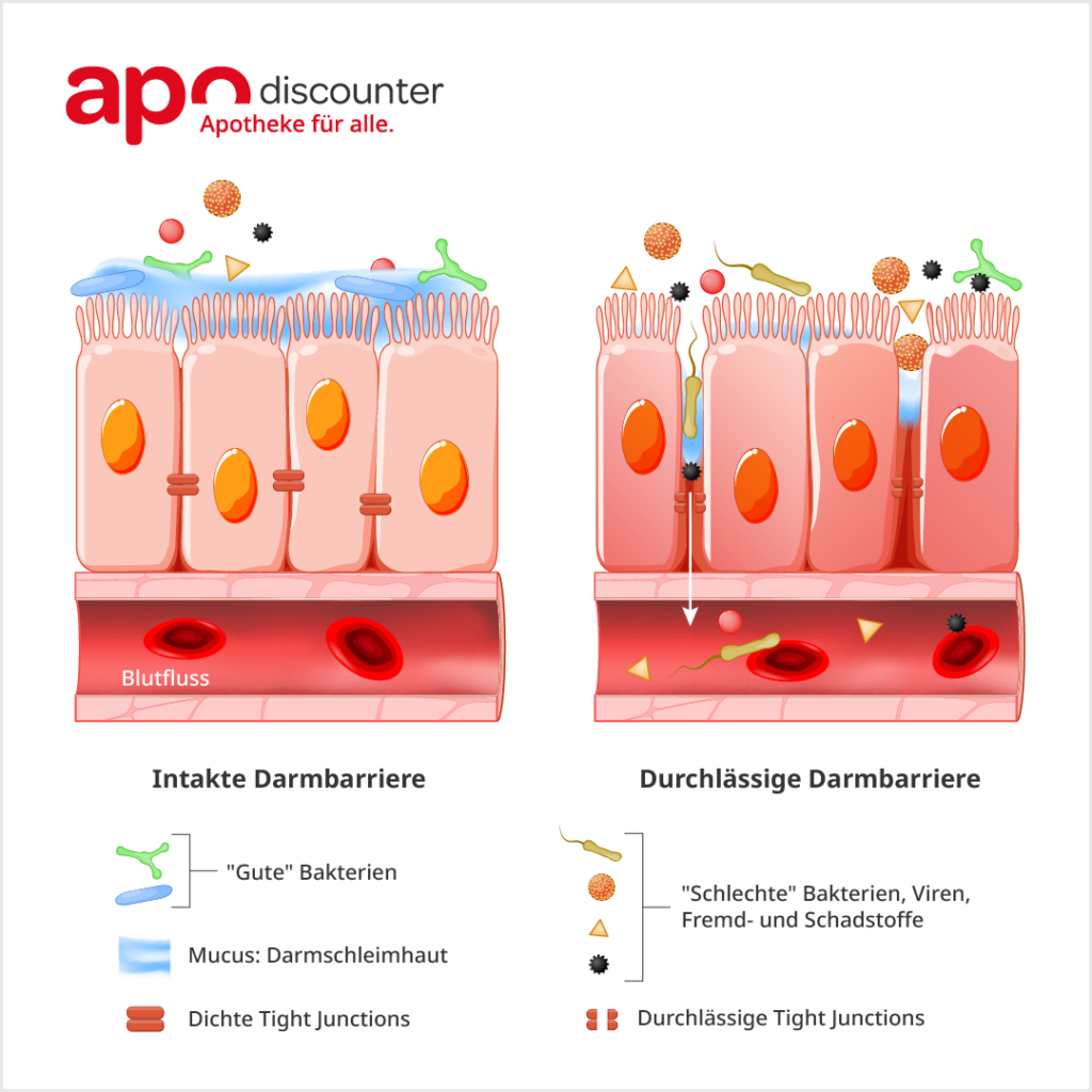 gesunder Darm vs. Leaky Gut