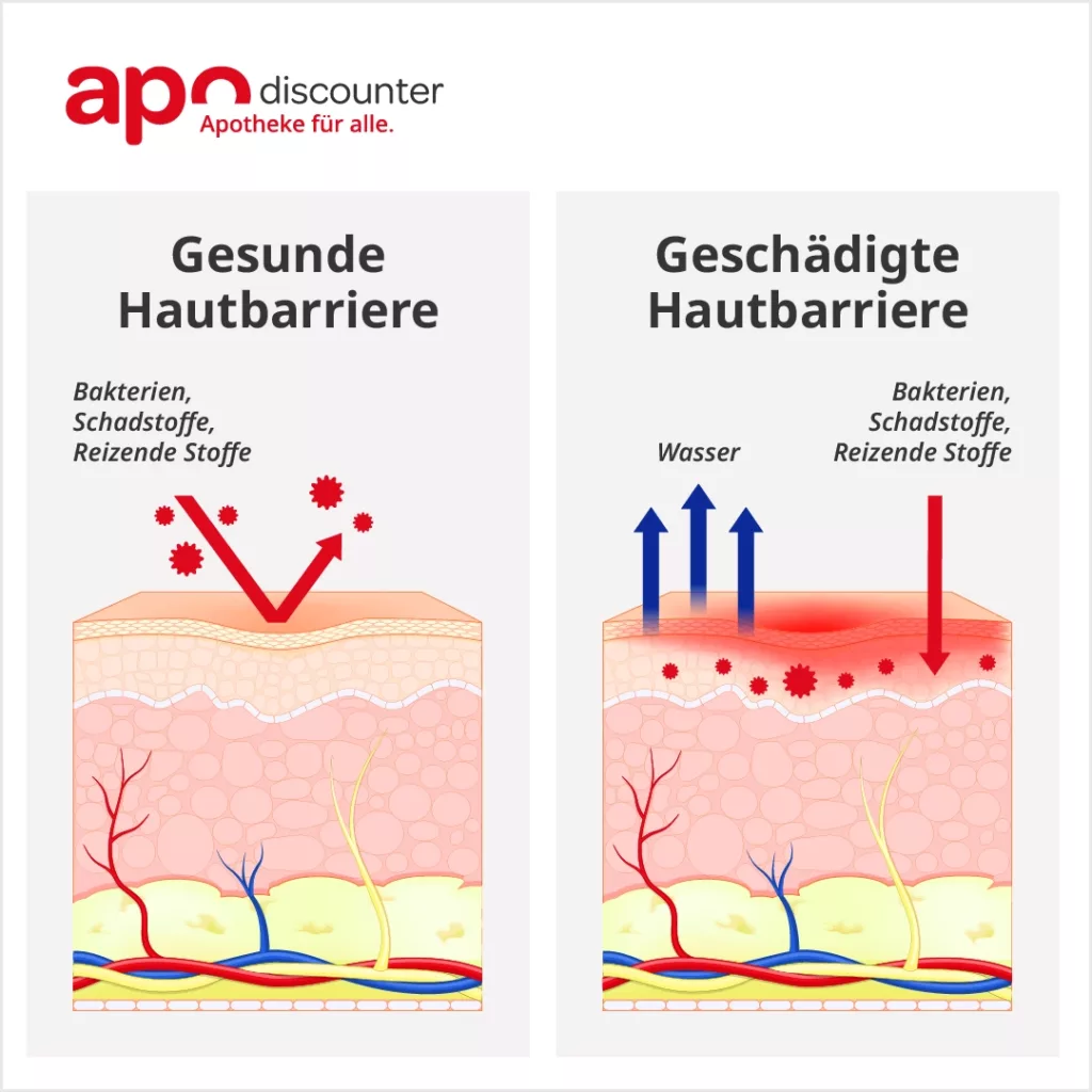 Hautbarriere erklärt