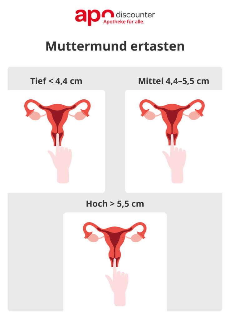 Grafik zur Bestimmung der Muttermundhöhe.