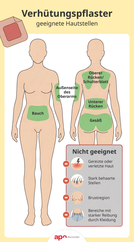 Verhütungspflaster: geeignete Hautstellen