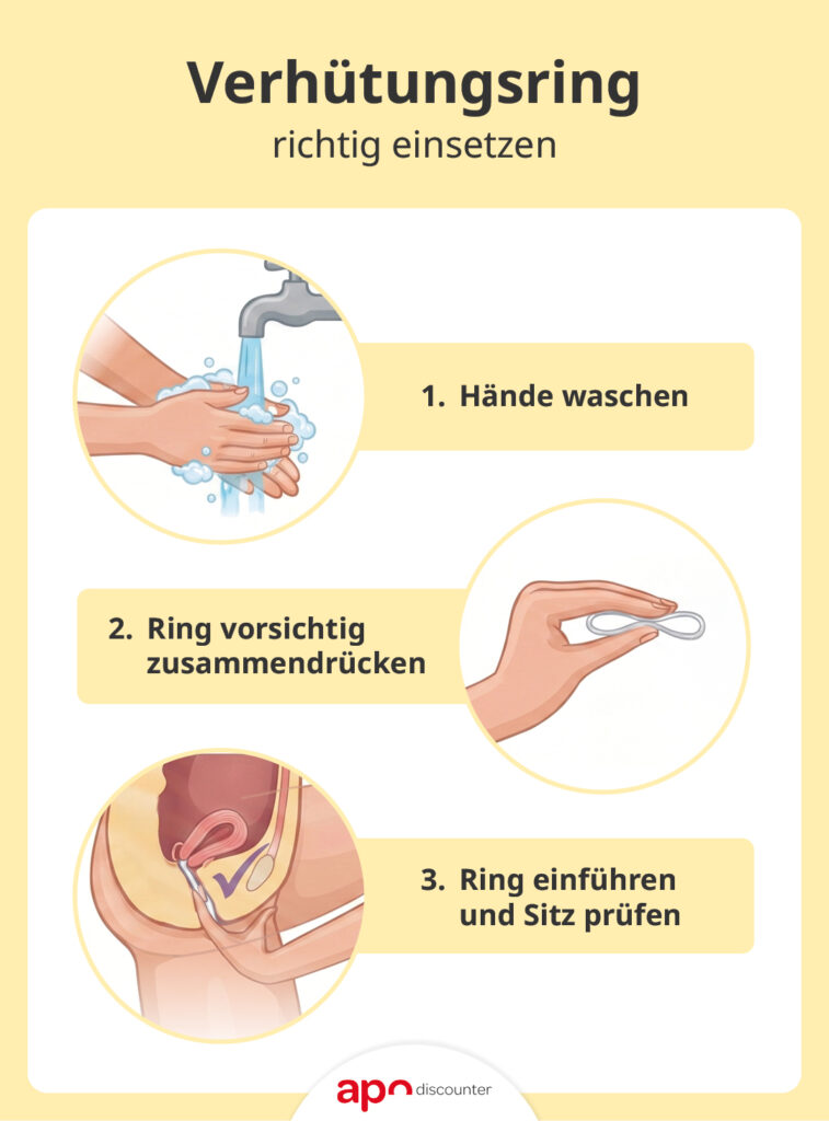 Verhütungsring Anwendung