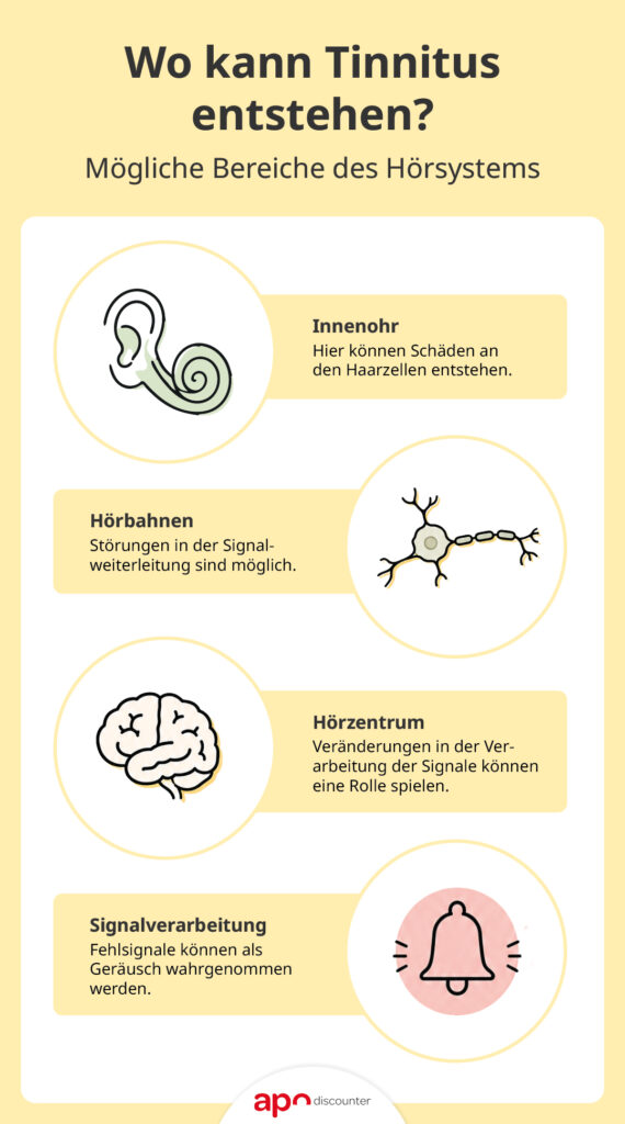 Tinnitus Infografik zu den möglichen Entstehungsorten im Hörsystem